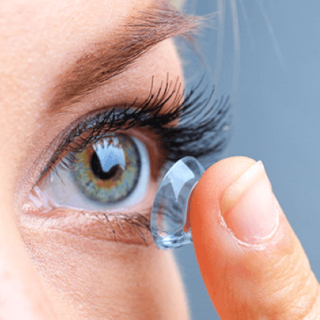 Contact Lens Consultation